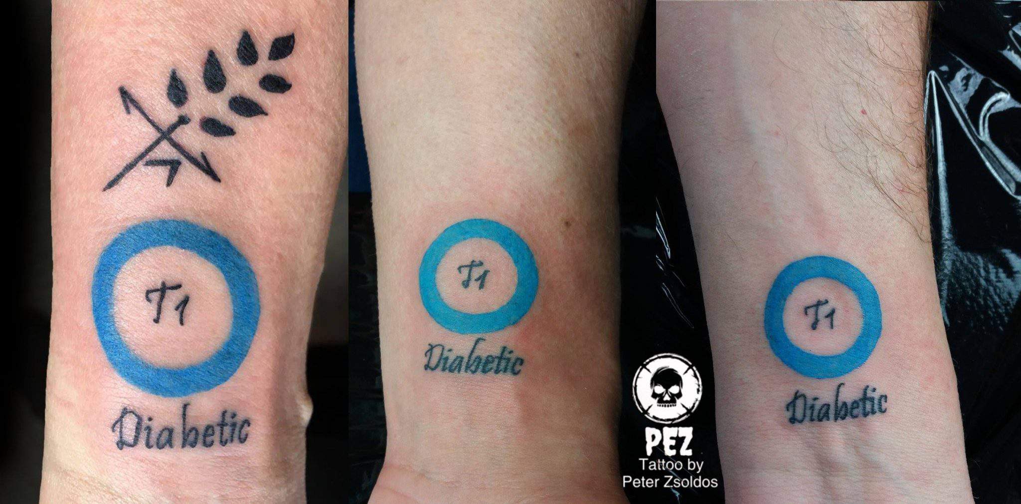Type 1 Diabetes stock image. Image of type, tattoos, tattoo - 88960641