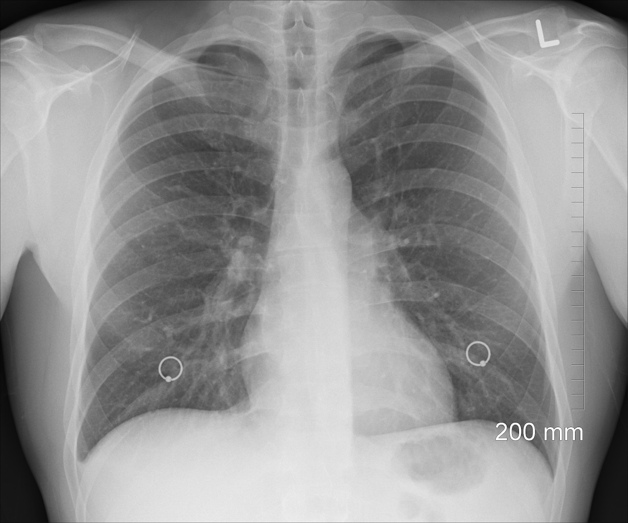 diagnosis-lung health