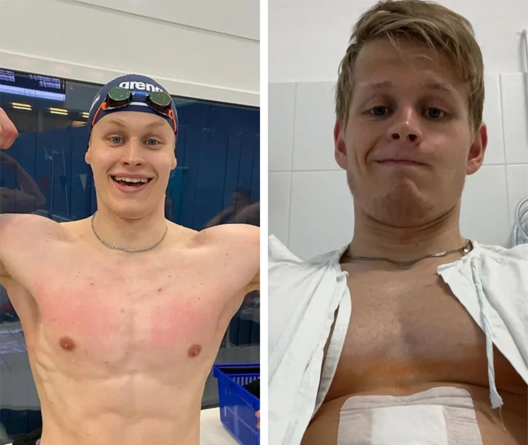 Norway swimmer Budapest hospital