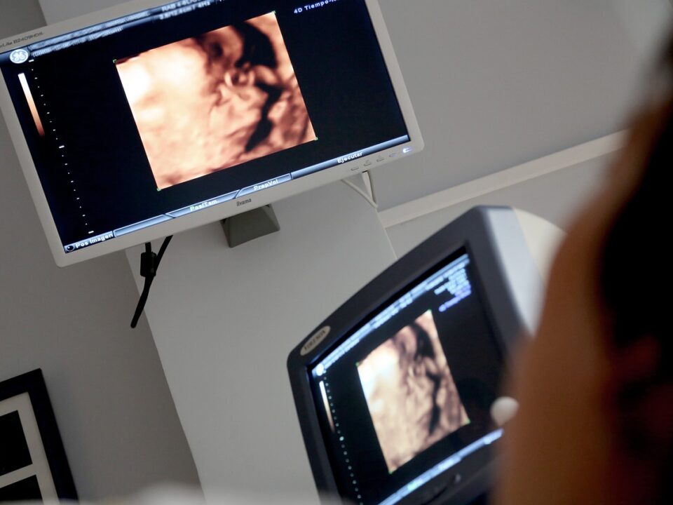 avortement par échographie